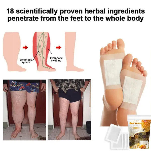 Bee Venom Lymphatic Drainage & Slimming Foot Patches (Set of 10 Patches)